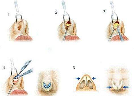 112efa.png 112efa.png